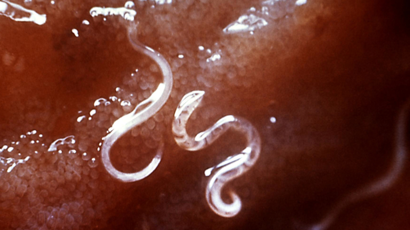 Illustration for article titled Why doctors are treating allergies with parasitic worms